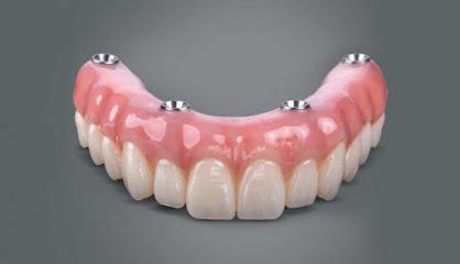 All On 4 Dental Implants - Periodontist in Parsippany, NJ