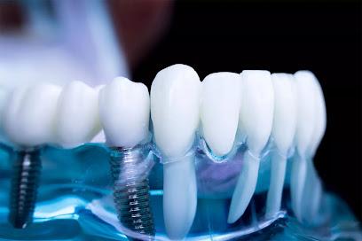 Affordable Dental Implants Albany - General dentist in Albany, NY