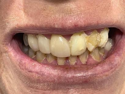 ACE dental - General dentist in Buffalo, NY